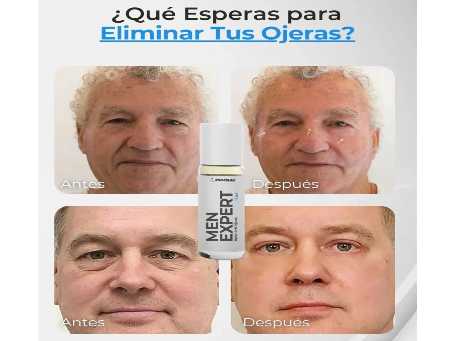 ANTIOJERAS